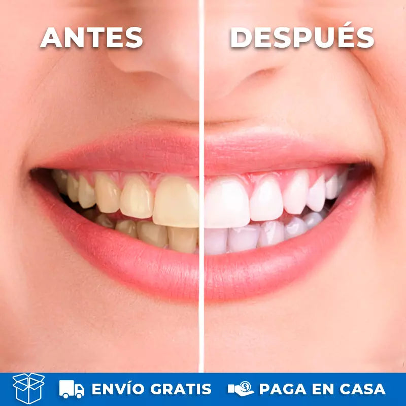 Irrigador Bucal Recargable - Mejora tu salud dental