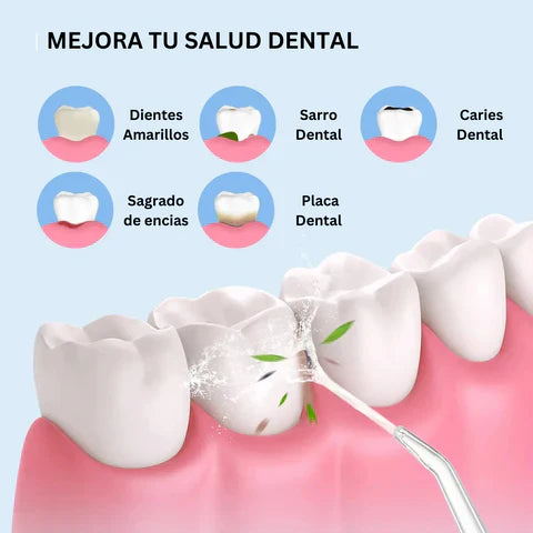 Irrigador Bucal Recargable - Mejora tu salud dental