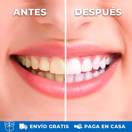 Irrigador Bucal Recargable
